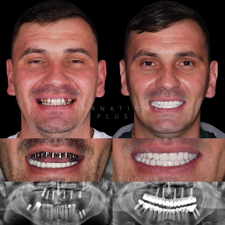 dental toronto before after 1