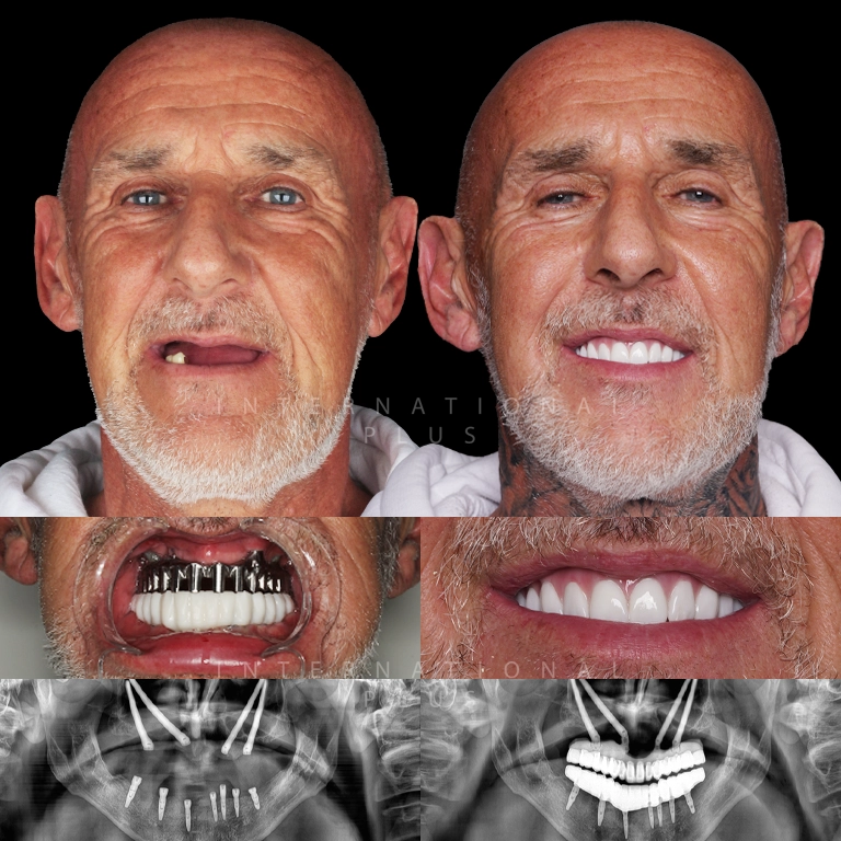 dental toronto before after 3