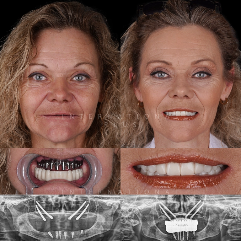 dental toronto before after 4