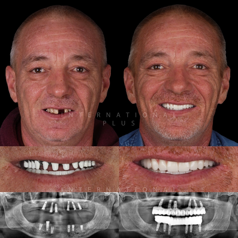 dental toronto before after 5