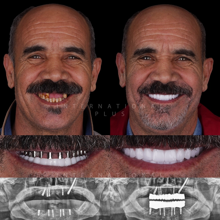 dental toronto before after 6