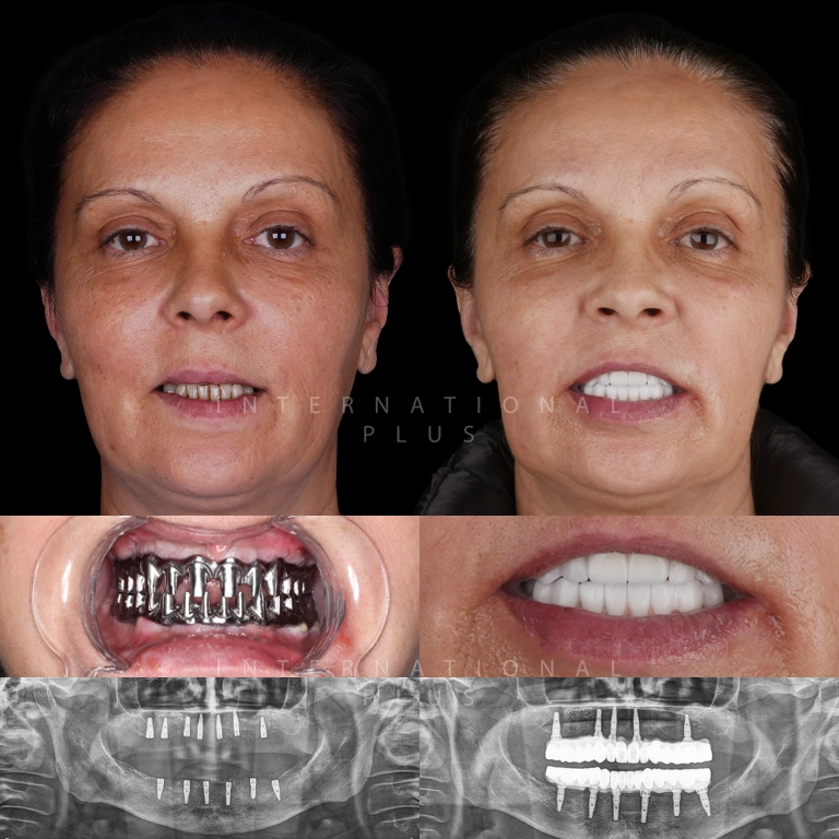 dental toronto before after 7