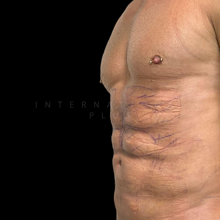 sixpack before after 10