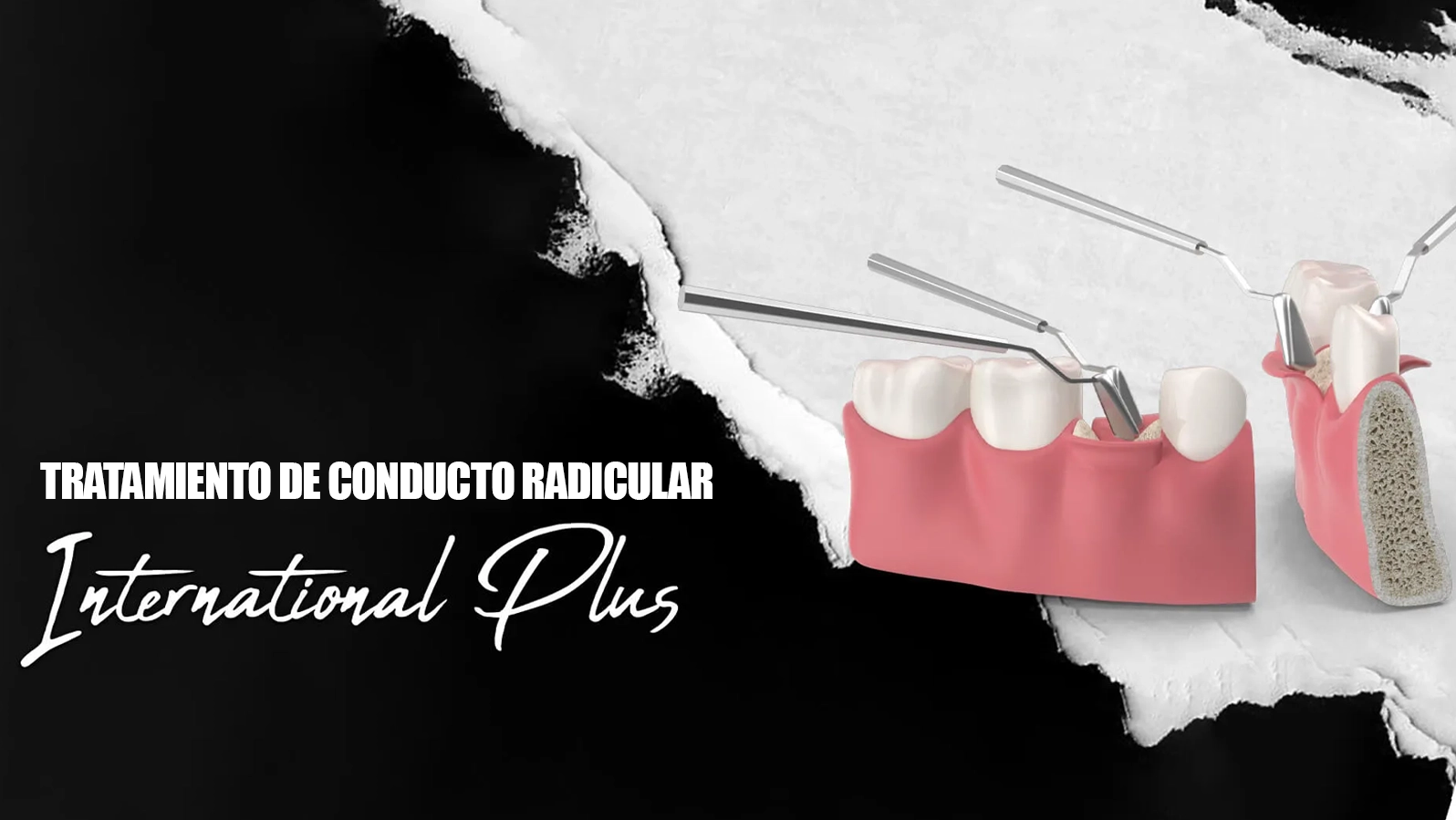 ¿Quien-califica-para-la-endodoncia_