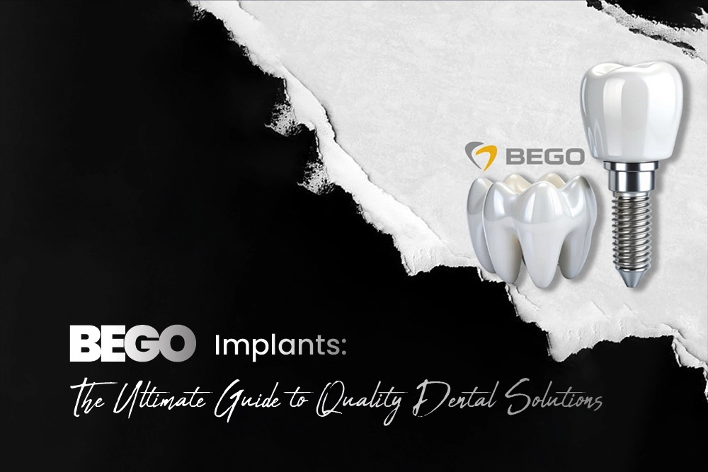 Bego Implants :The Ultimate Guide to Quality Dental Solutions