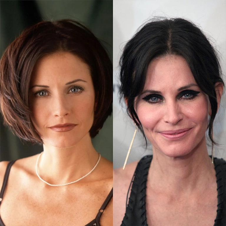 Courteney Cox Fillers Story 