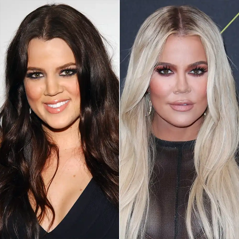 How Has Khloé Kardashian Addressed Criticism About Her Enhancements