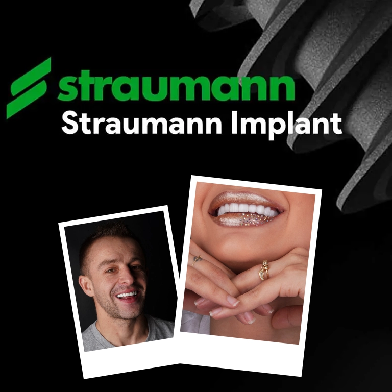 How Much Do Straumann Implants Cost