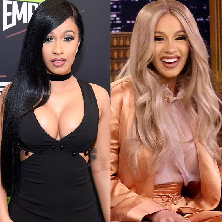 What Are the Risks of the Procedures Cardi B Chose