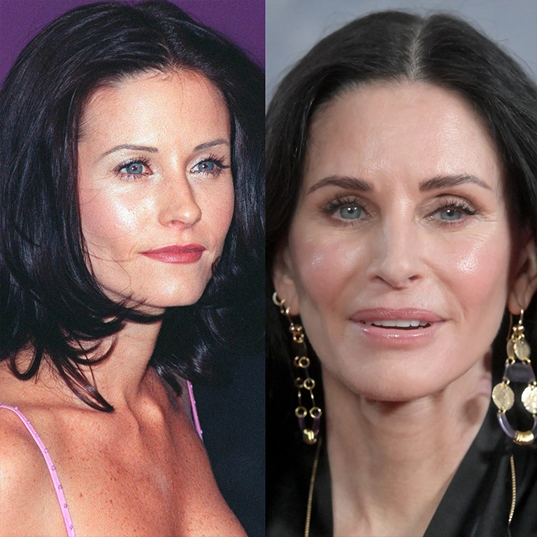 What Led Courteney Cox to Dissolve Her Fillers