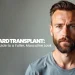 Beard Transplant Your Guide to a Fuller Masculine Look