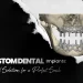 Custom Dental Implants Tailored Solutions for a Perfect Smile