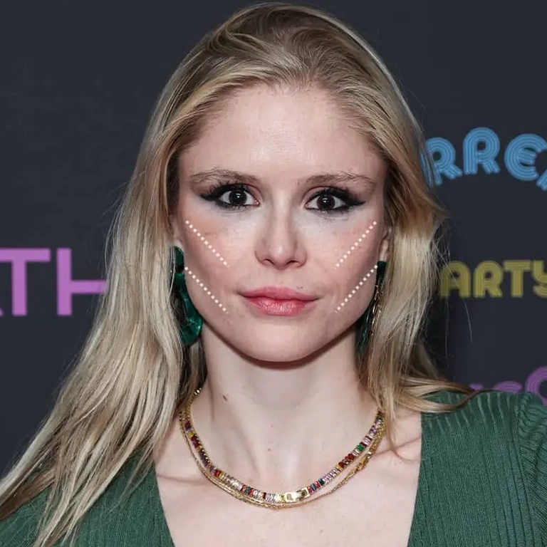 Has Erin Moriarty’s Career Been Affected by Plastic Surgery Speculations