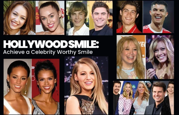 Hollywood Smile Achieve a Celebrity Worthy Dental Smile