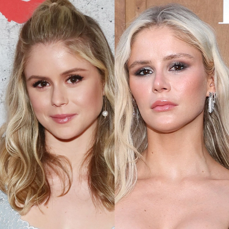 How Erin Moriarty Appearance Sparked Plastic Surgery Discussions