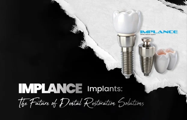 Implance Dental Implants The Future of Dental Restoration Solutions