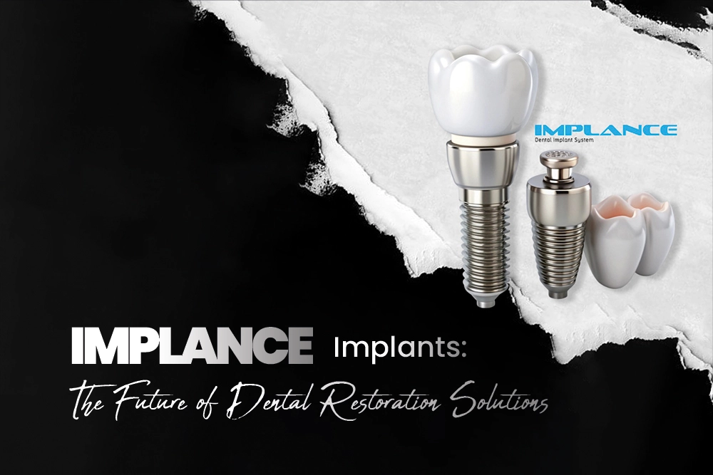 Implance Dental Implants The Future of Dental Restoration Solutions