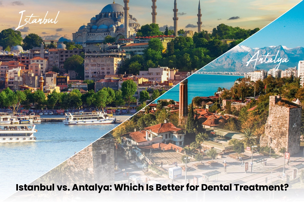 Istanbul vs Antalya Which Is Better for Dental Tourism in Turkey?