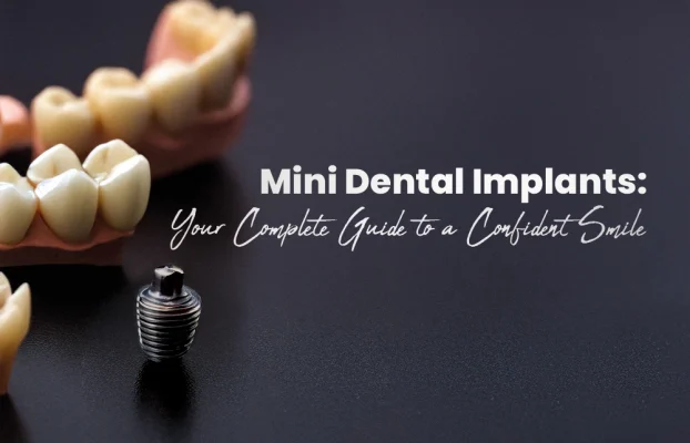 Mini Dental Implants: Your Complete Guide to a Confident Smile