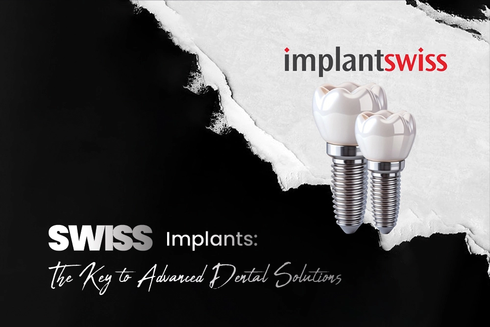 Swiss Dental Implants The Key to Advanced Dental implant Solutions