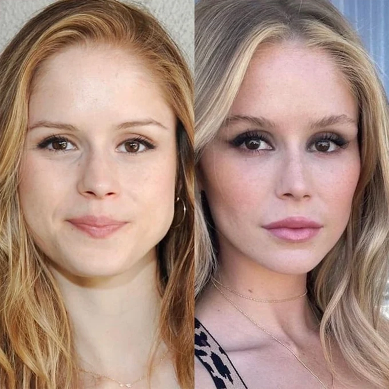 Which Plastic Surgery Procedures Is Erin Moriarty Rumored to Have Had