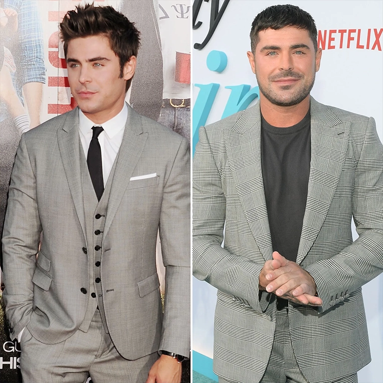 Zac Efron Jaw Before and After