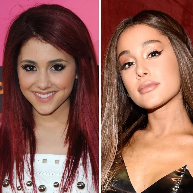 Ariana Grande Aging Secrets: Skincare Routine or Cosmetic Work?