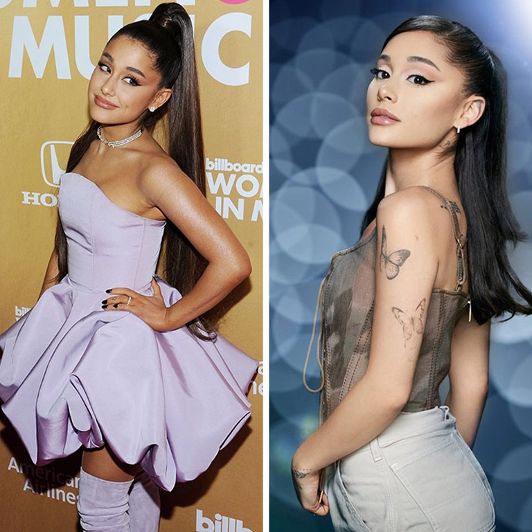 Ariana Grande Lip Fillers