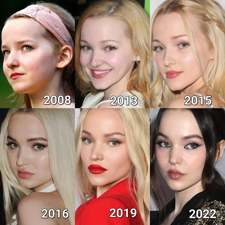 Did Dove Cameron Have Plastic Surgery Before Liv and Maddie