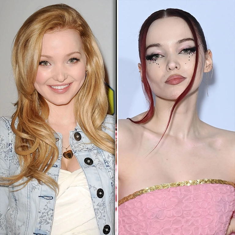 Dove Cameron Eye Surgery