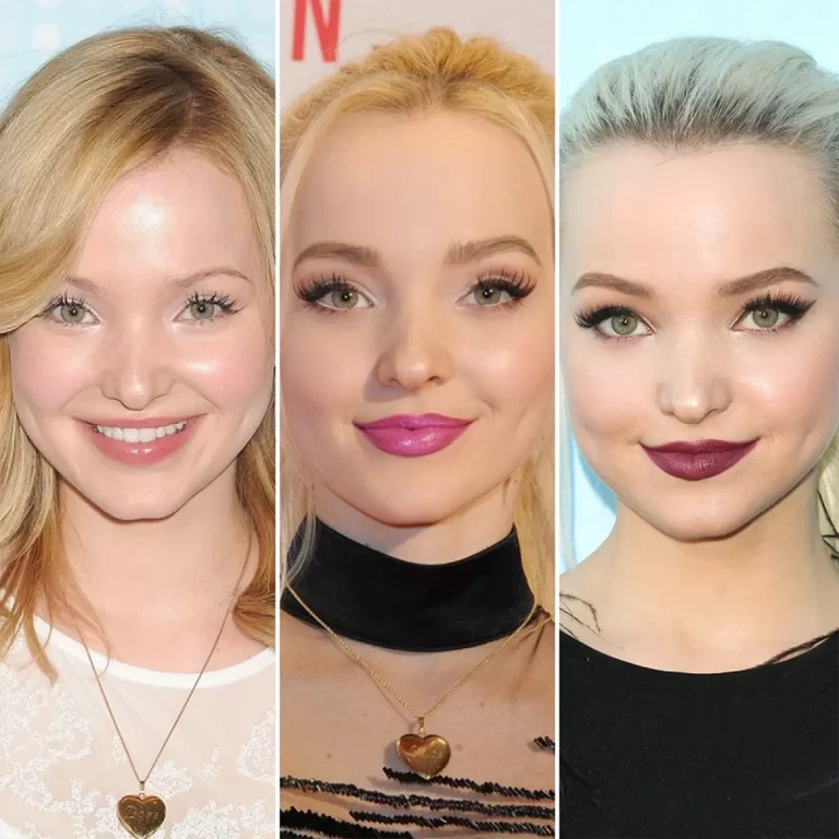 Dove Cameron Lip Fillers