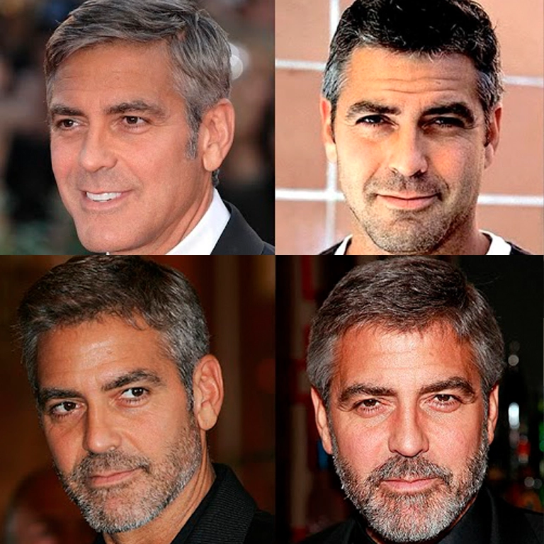 How George Clooney’s Signature Look Inspires Men to Opt for Beard Transplants