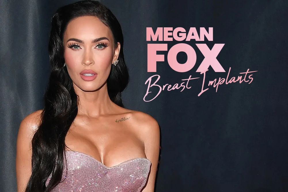 Megan Fox Breast Implants