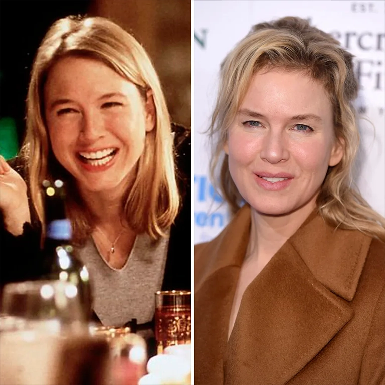 Renée Zellweger Before and After