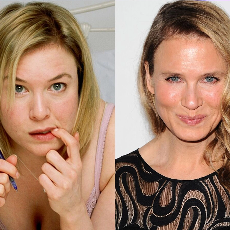 Renée Zellweger Without Fillers How Has Her Face Aged Naturally