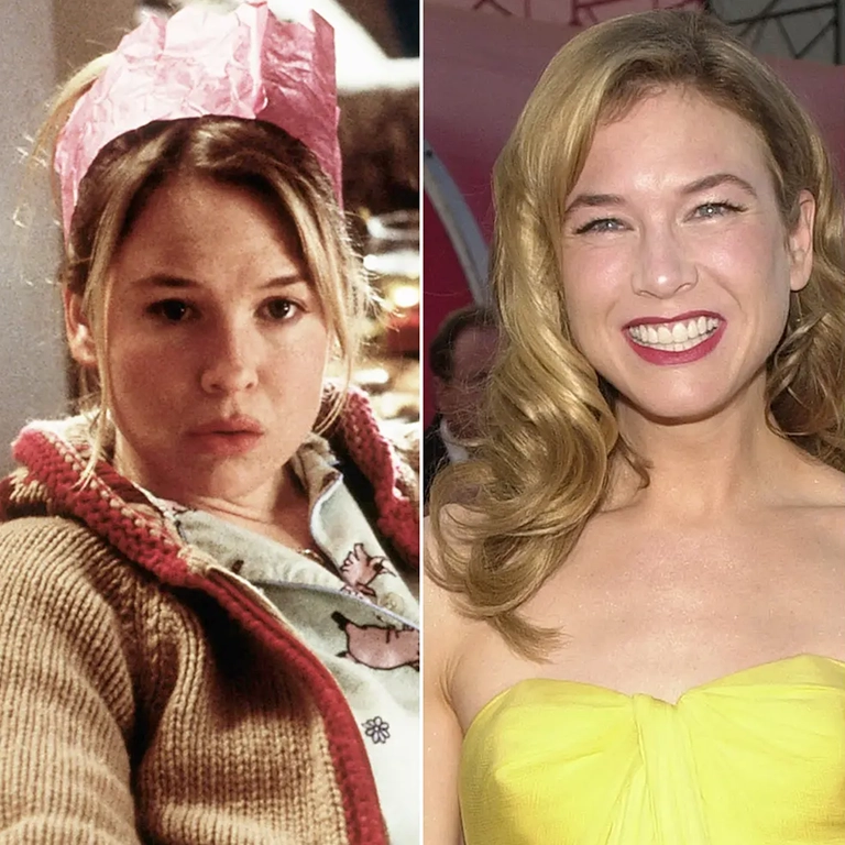 Renée Zellweger’s Brow Lift