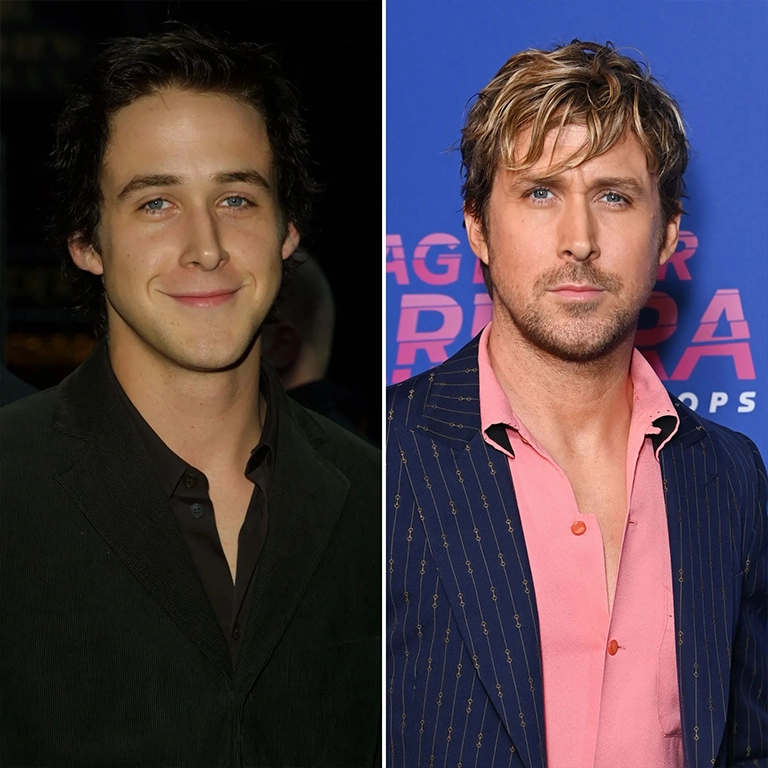 Ryan Gosling Facial Symmetry Has He Had Any Enhancements