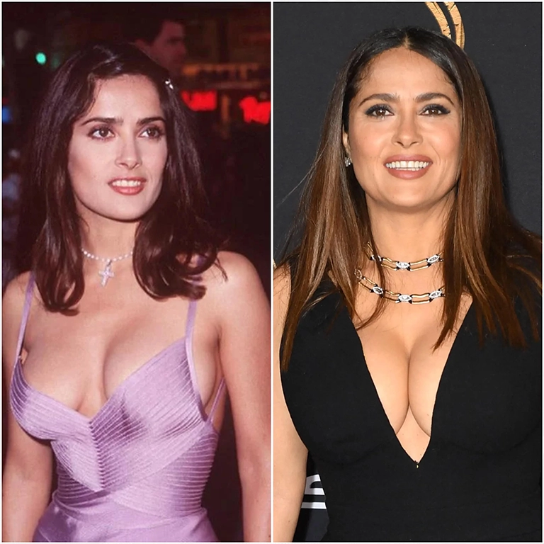 Salma Hayek Plastic Surgery Fat Transfer vs Silicone Implants