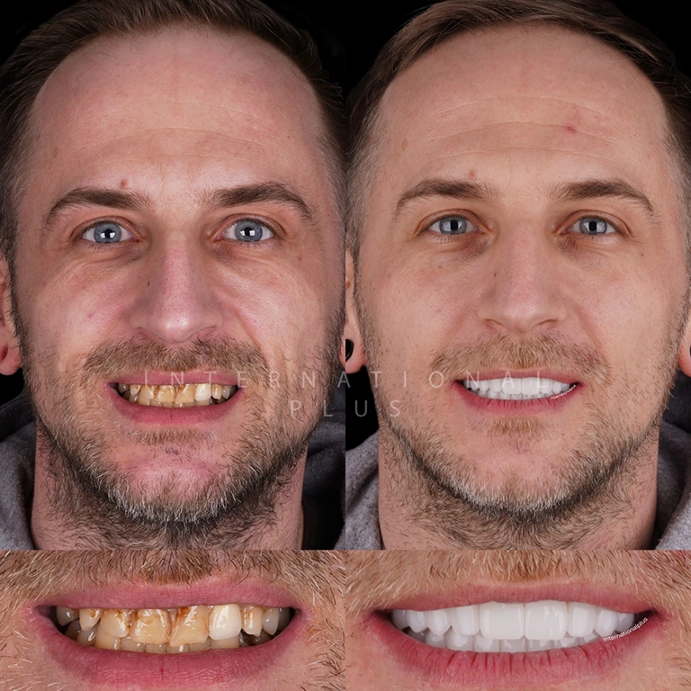 Digital Smile Design