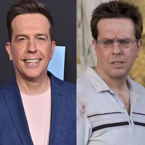 Ed Helms Before and After Hair Implant