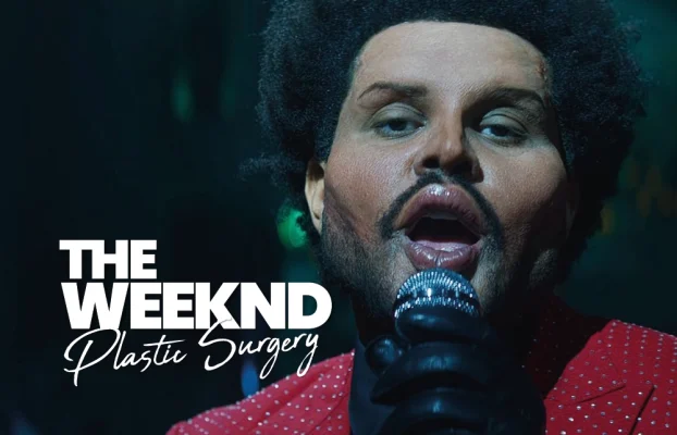 The Weeknd Plastic Surgery