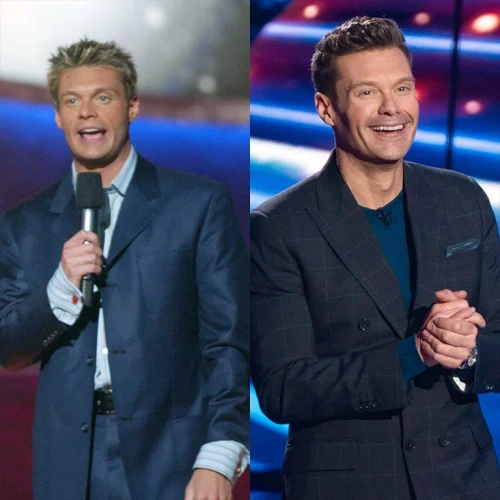 Ryan Seacrest Aesthetic Transformation