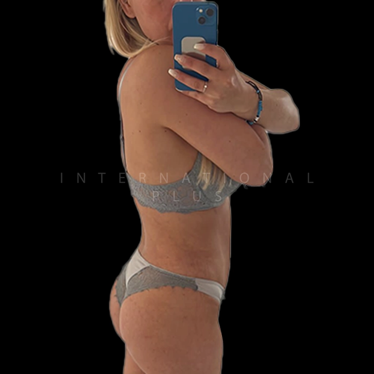 All Treatments Before After 26
