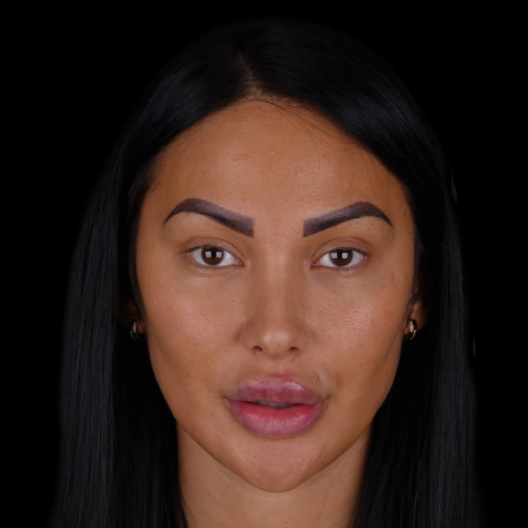 All Treatments Before After 31