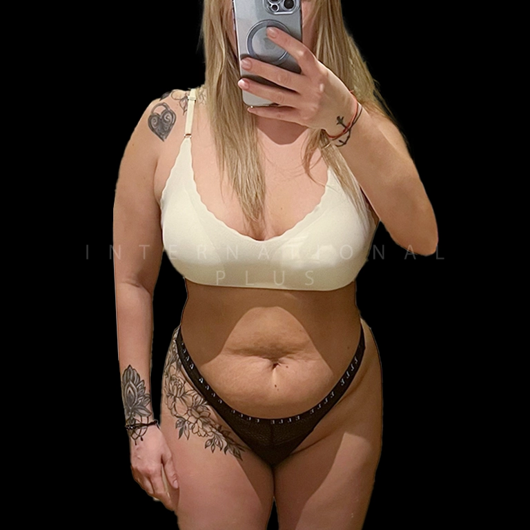 All Treatments Before After 41