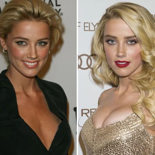 Amber Heard Before and After