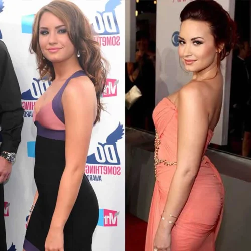 Demi Lovato Before and After