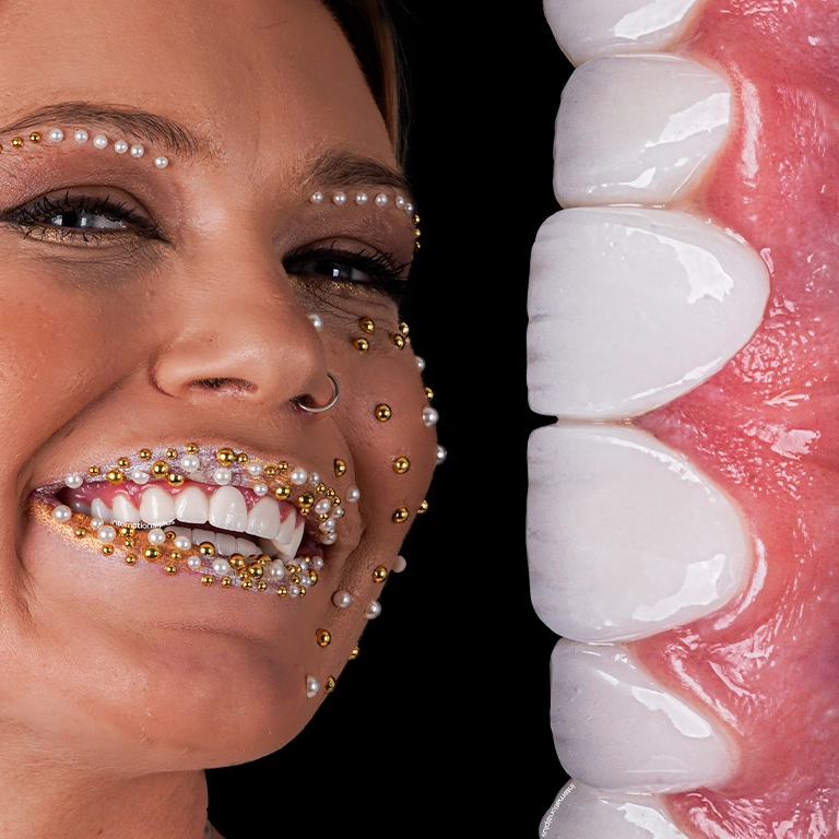 Dental Implant