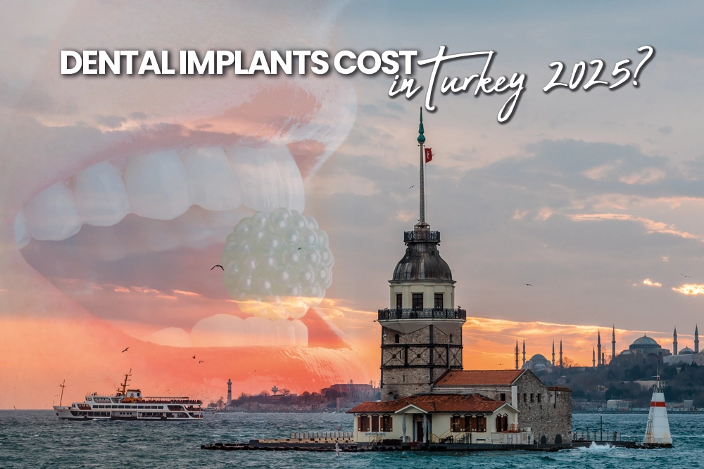Dental Implants Cost in Turkey 2025?