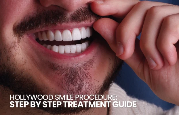 Hollywood Smile Treatment Procedure
